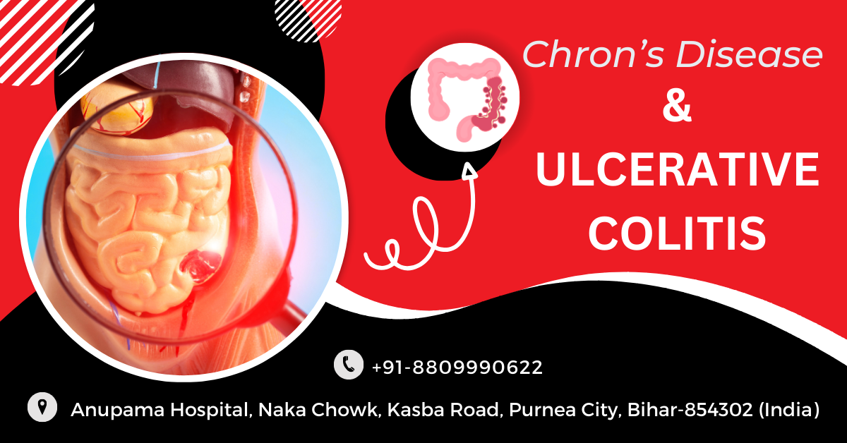 Chron’s Disease & Ulcerative Colitis