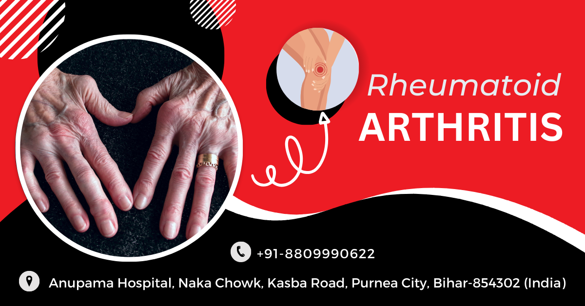 Rheumatoid Arthritis